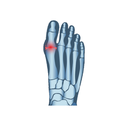 Urinary - GOUT White.webp