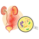 Urinary - UTI White.webp