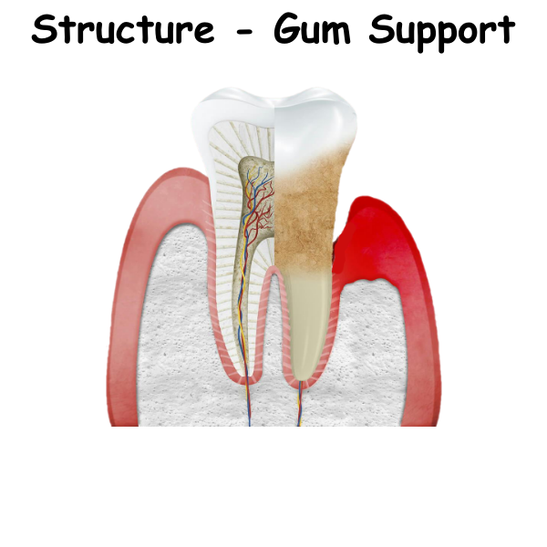 Structure - Gum Support ST